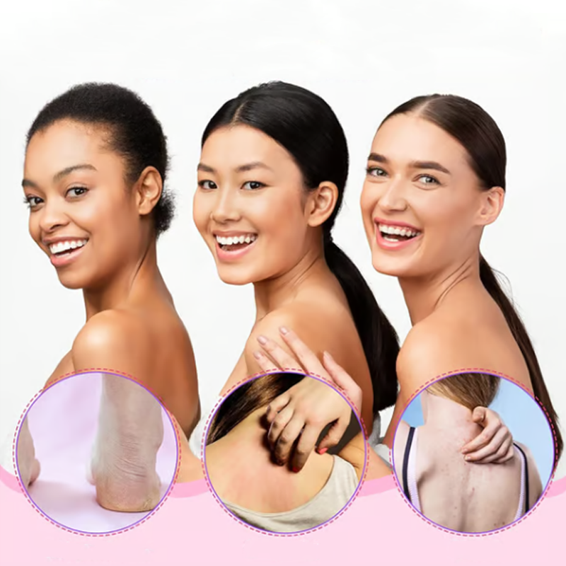Serviette Exfoliante pour le Dos avec Poignées