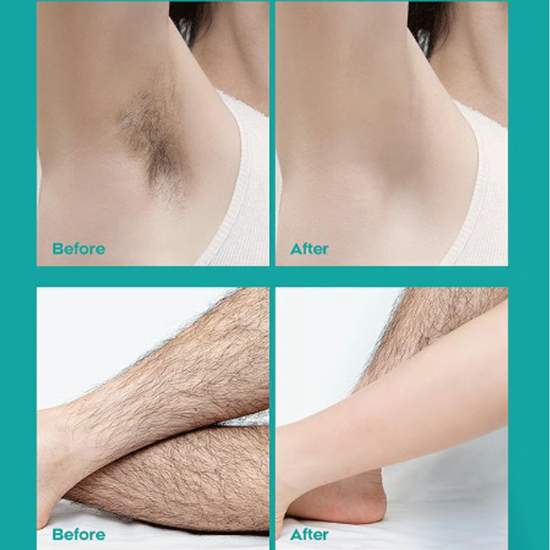 🔥Crème épilatoire indolore pour tout le corps, hommes et femmes – Douce pour toutes les zones🌿